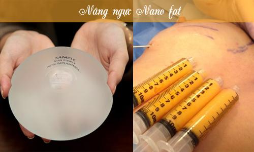 Phẫu thuật nâng ngực Nano chip là gì? Phân biệt làm ngực Nano Chip và Nano Fat